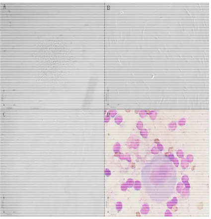Figura 4. Caracterización morfológica de células adherentes de MO presuntivas de CMM. (A) Unidad formadora de colonia fibroblastoide (cultivo en 1fibroblastoides adherentes