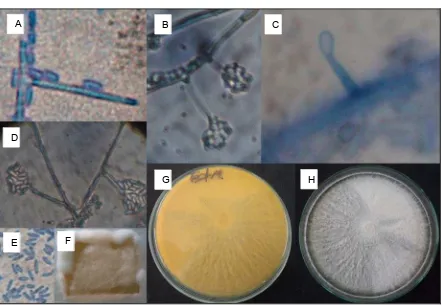 Fig 1. AG: Anverso Agar MEA color amarillo crema. H: reverso Agar MEA color blanco, textura acompañado de hifas de 15µm-20µm aprox