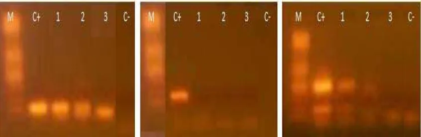 Fig. 4. Evaluación de amplificación por PCR del gen mitocondrial 16S de algunas de las muestras fecales para: A) fragmentos de 135 pb B) fragmentos de 335 pb C) fragmentos de 563pb