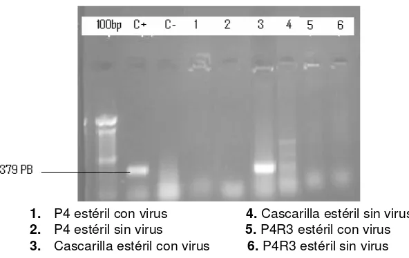 Figura 4. Producto de la RT-PCR para la Identificación del gen VP6 de rotavirus en muestras usadas 
