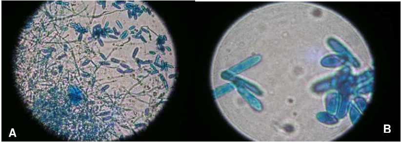 Figura 7. Características microscópicas de C. gloeosporioides. A: Micelio y conidias del hongo formadas en PDA, B: Conidias típicas del microorganismo