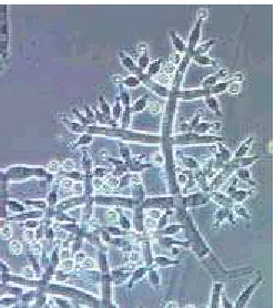 Figura 10. Microscopia de Trichoderma sp.  Fuente: Systematic Botany and Mycology Laboratory, 2006 