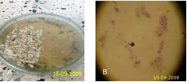 Fig 3.  Obtención levadura: Figura A. Candida gilliermondii en medio YGC, Figura B. Coloracion de Gram de la levadura