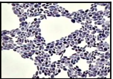Figura 3. Vista Microscópica de Saccharomyces cerevisiae (http://www.n-t.ru/tp/nr/mk_p02.jpg)