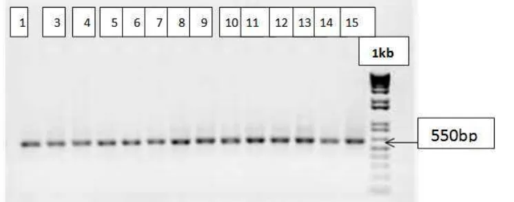 Figura 2: Productos de PCR de algunas de las muestras donde se observa el fragmento de aproximadamente 550 pares de bases obtenido