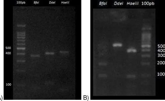 Figura 4. Patrones RFLP del fragmento ITS1-5.8S-ITS2 rDNA digerido con las enzimas BfaI, DdeI y HaeIII