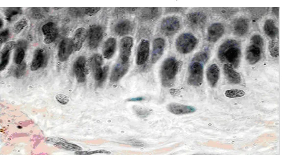 Figura 3. Estructura de los queratinocitos. 