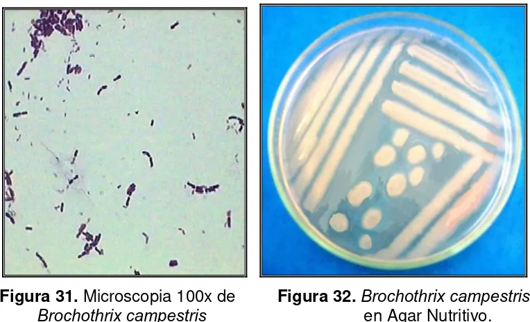 Tabla 25. Características Bioquímica de Brochothrix campestris 