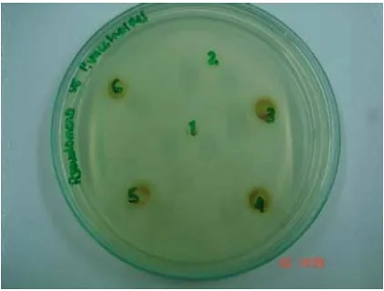 Figura 1. Montaje de antibiograma representan la ubicación consecutiva de los discos  control positivo,  negativo y los diferentes  Pseudomonas fluorescens en agar Tripticasa de Soya  Los números extractos acuosos proteicos, como se muestra en la Tabla 4