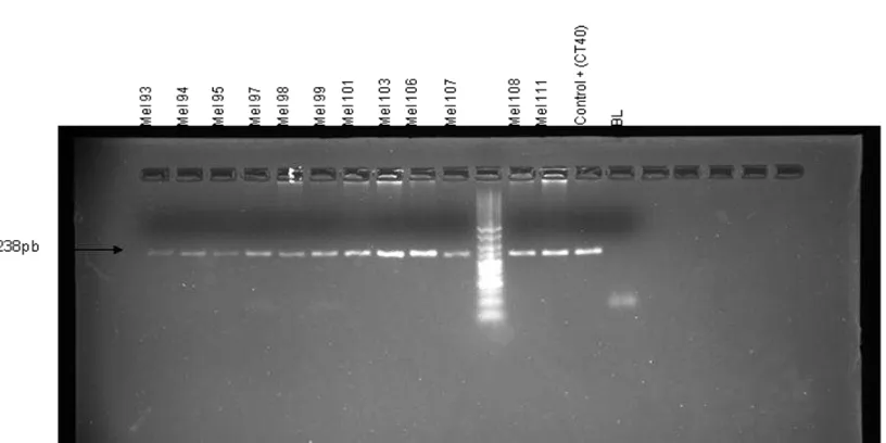 Figura 2: Productos de amplificación por PCR de la región que contiene el polimorfismo Lys751Gln del gen XPD en alguno de los casos
