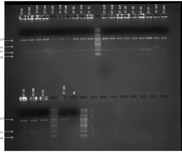 Figura 3: RFLPs obtenidos con la enzima Hha1 de los productos amplificados por PCR que contienen el polimorfismo Arg151Cys de MC1R en alguno de los controles