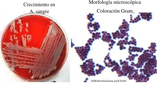 Figura 2.5  Staphylococcus aureus 