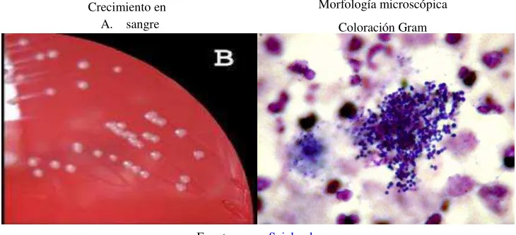 Figura 2.6  Staphylococcus coagulasa negativa 