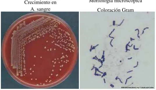 Figura 2.7 Corynebacterium bovis 