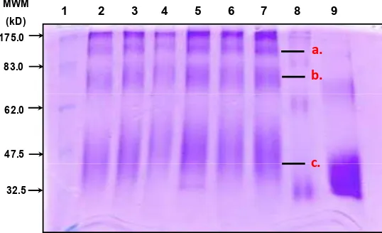Figura 8. Geles SDS- PAGE 7.5 % de pseudopéptidos conjugados a albumina derivados de la proteína MSP-1 del P