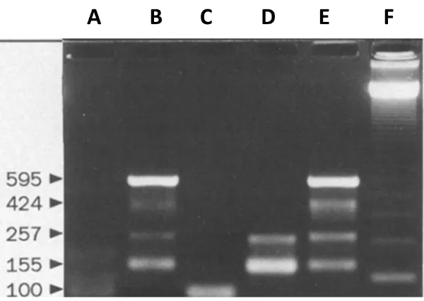 Figura 9. PCR anidada – Gel de electroforesis de agarosa 2% para PCR 16s/23S/especie específico  Mycoplasma hominis F