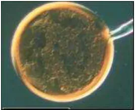 Figura 2.  Espora de Glomus sp. mostrando la hifa. Tomado de Redecker y Raab. (2006)  