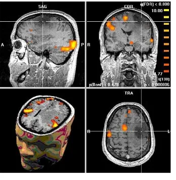 Figura 1.8: Imagenes de Resonancia Magnetica (IRM):