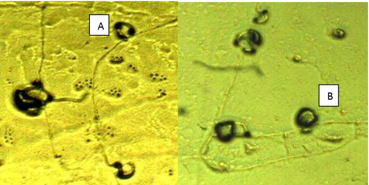 Figura 9.  A) Anillo constrictor B) Anillo simple observados durante el aislamiento de los hongos nematófagos