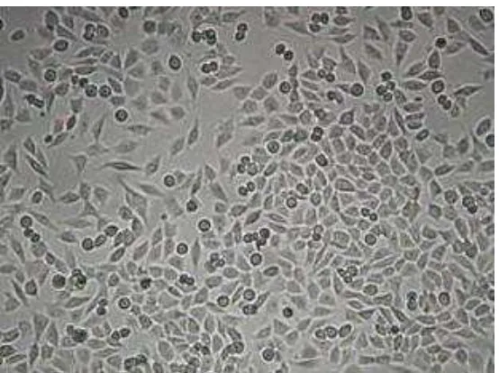 Figura 7. Aspecto de la línea celular de melanoma maligno cutáneo humano A-375 en cultivo (10X)