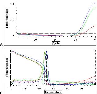 Figura 20. Tirosinasa: A. Curvas de amplificación generadas por PCR tiempo real con diferentes temperaturas de anillamiento de los primers que amplifican una región de ADNc de tirosinasa a partir de una muestra de A-375