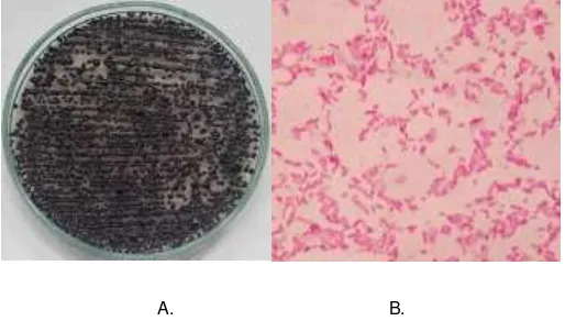Fig. 2.A) Características macroscópicas de Janthinobacterium lividum en agar PDA y B) Observación microscópica 100x