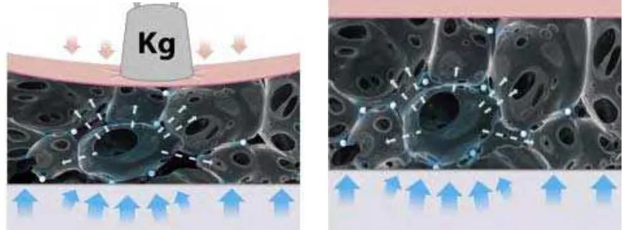 Figura 9. Alteración celular por la presión sobre la piel.  