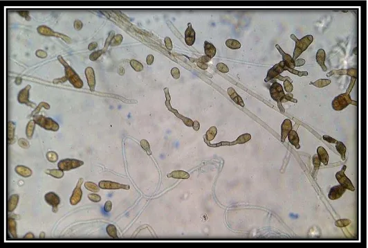 Figura 5. Presencia de conidios y micelio fúngico (Alternaria sp., 40x). Cornejo, 2014