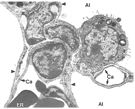 Figura 1. Neumocito tipo II 