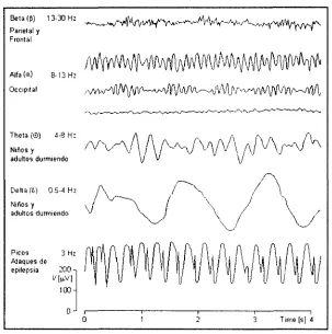Figura 2.1: Ejemplos de señales EEG