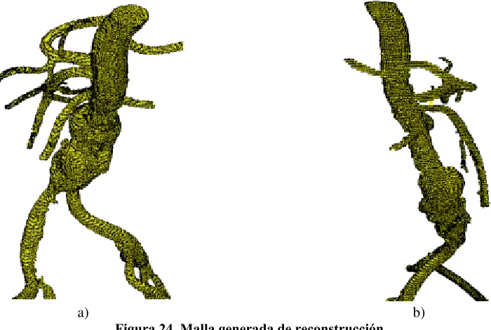 Figura 24. Malla generada de reconstrucción. 