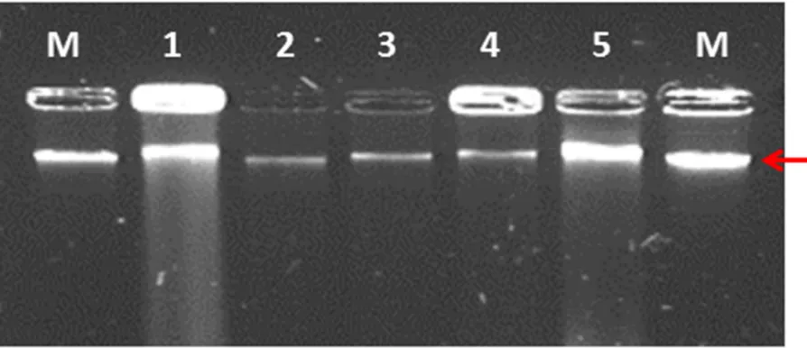 Figura 1. Electroforesis del aislamiento del DNA de cinco muestras de micelio de 