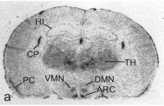 Figura 3. Experimento de hibridación isoformas del receptor) en un corte sagital del cerebro de rata