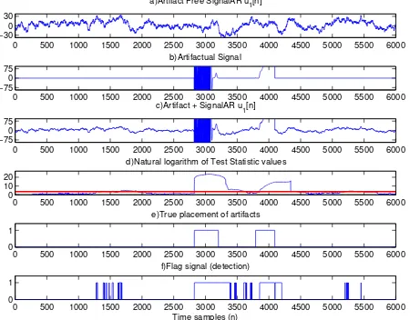 Fig. 5.35Online performance of CCDA with BR estimated threshold fromL′ = 250 samples and AR signal ˆu[n]
