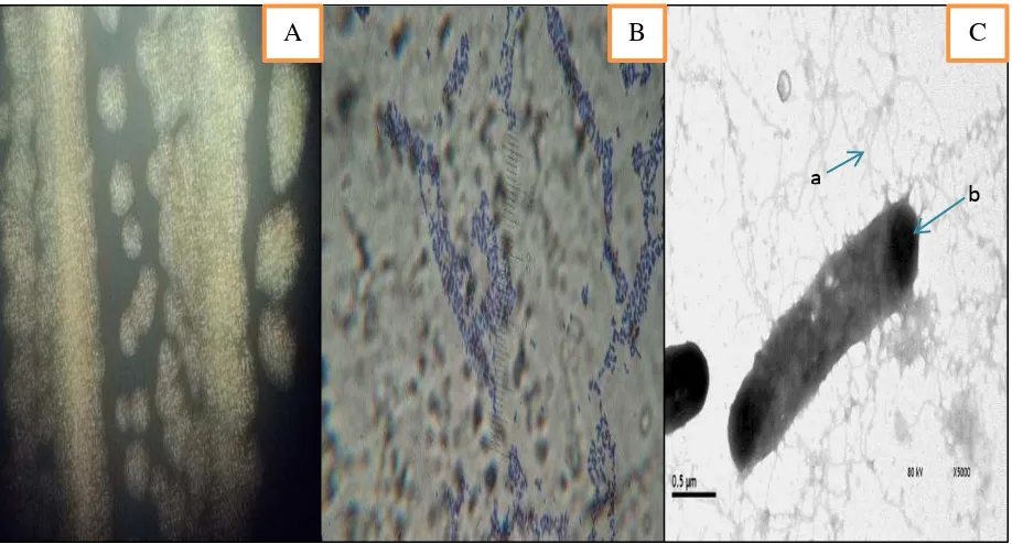 Fig. 7. Identificación morfológica de Bacillus pumilus: A) Morfología de la bacteria; B) Tinción de Gram (+), C) Célula bacilar; a) flagelos perítricos, b) endospora terminal (5000X)