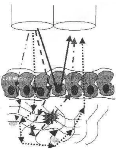 Figura 2.10: Tipos de re‡exión de luz sobre un tejido cervical[15]