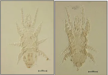 Figura 2.38. Dendrolaelaps neocornutus: A) hembra y B) Macho. 