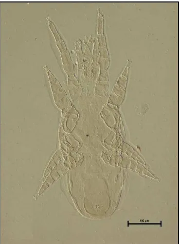 Figura 2.40. Dendrolaelaps neodisetus hembra vista ventral 