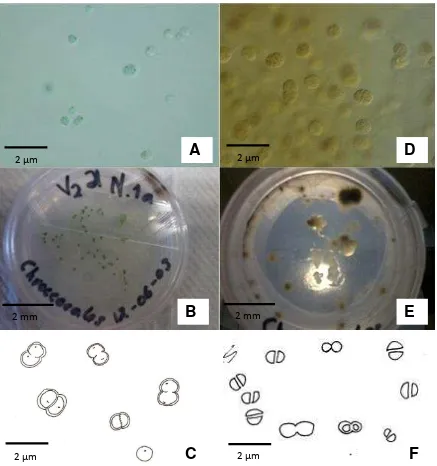 Figura 5. Especies del género Synechocystiscreciendo en mucílago de planos. en medio de cultivo BG11, colonias verde-azulosas, difluente