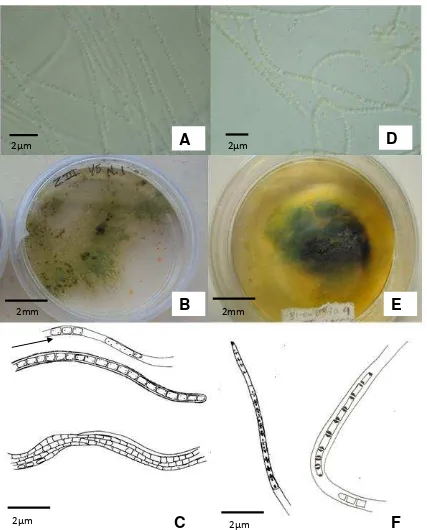 Figura. 6  Pseudanabaena amphigranulata y Leptolyngbya granulifera en medio de cultivo BG11