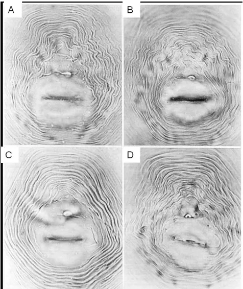 Figura 3: A-D. Patrones perineales de Meloidogyne incognita, 1983). tomado de (Eisenback et al.,  