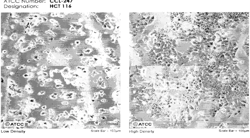 Figura 7.  Morfología de la línea celular HCT116 de cáncer de colon en microscopio ópticoen baja y alta densidad de crecimiento (The Global Biosurce Center, 2004).