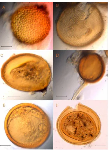Figura 5.2. Esporas de hongos micorrízicos arbusculares identificados de la rizosfera de 