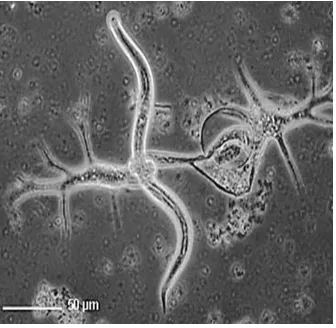 Figura 2. Microfotografía mostrando el aspecto de una ameba de la especie Theratromyxa weberi, enquistando a un nematodo (Fuente: Sayre y Wergin, 1989)