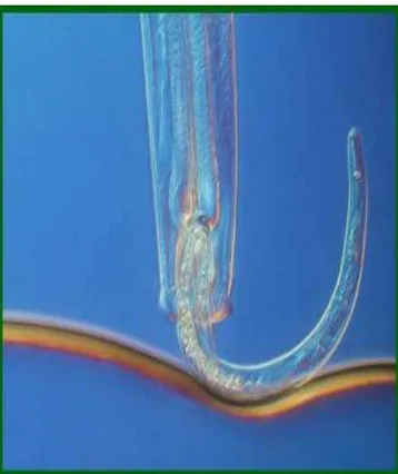 Figura 8. Aspecto de un nematodo depredador del género Mononchus sp. alimentándose de un nematodo fitopatógeno Pratylenchus sp