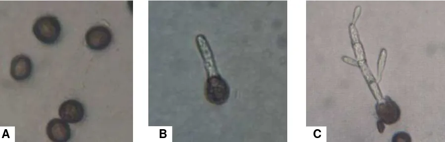 Figura 1. Fase saprofítica de Sporisorium reilianum f. sp. zeae en medio de cultivo PDA