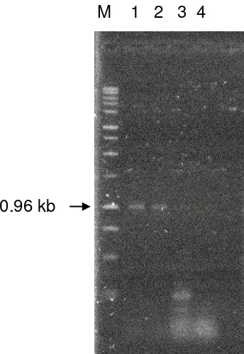 Figura 3. Productos de amplificación mediante PCR empleando el par de iniciadores SR1 y SR2; M