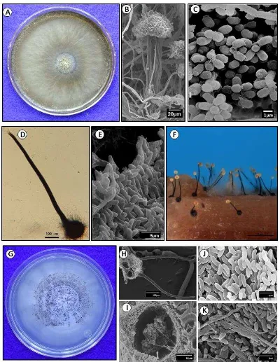 Figura 2 . Características culturales y microscópicas (microscopia de luz y microscopía 