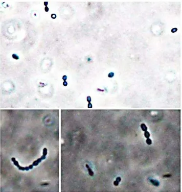 Figura 1.3. Bacteria celulolítica aislada observada a 1000 