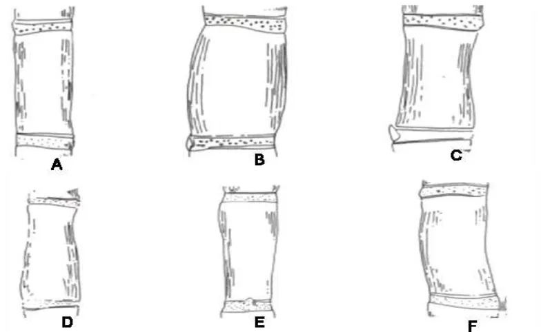 Figura 3. Aspecto longitudinal de tallos de caña de azúcar: A) cilíndrica; B) Abarrilado; C) En forma de huso; D) Conoidal; E) Obconidal; F) Cóncavo convexo